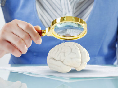 brain cells and obesity
